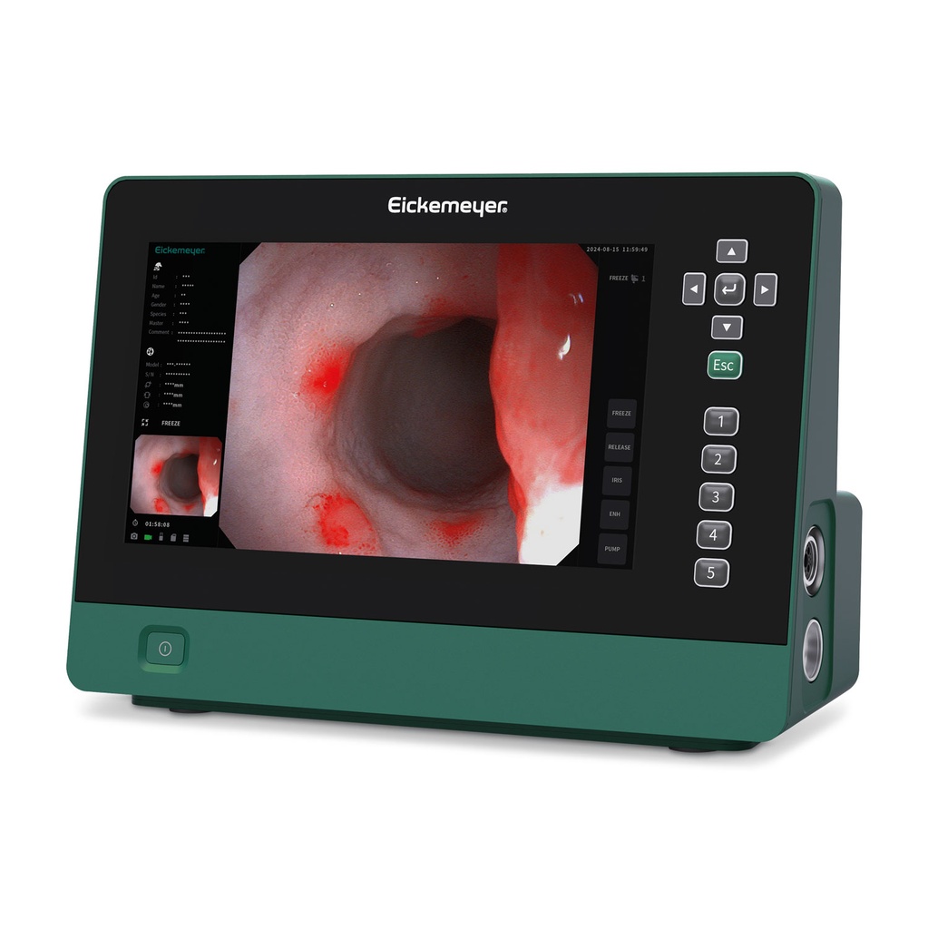 EickView 5-in-1 endoscopiesysteem